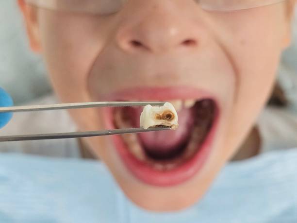 Best Weekend Emergency Dentist in Mullens, WV